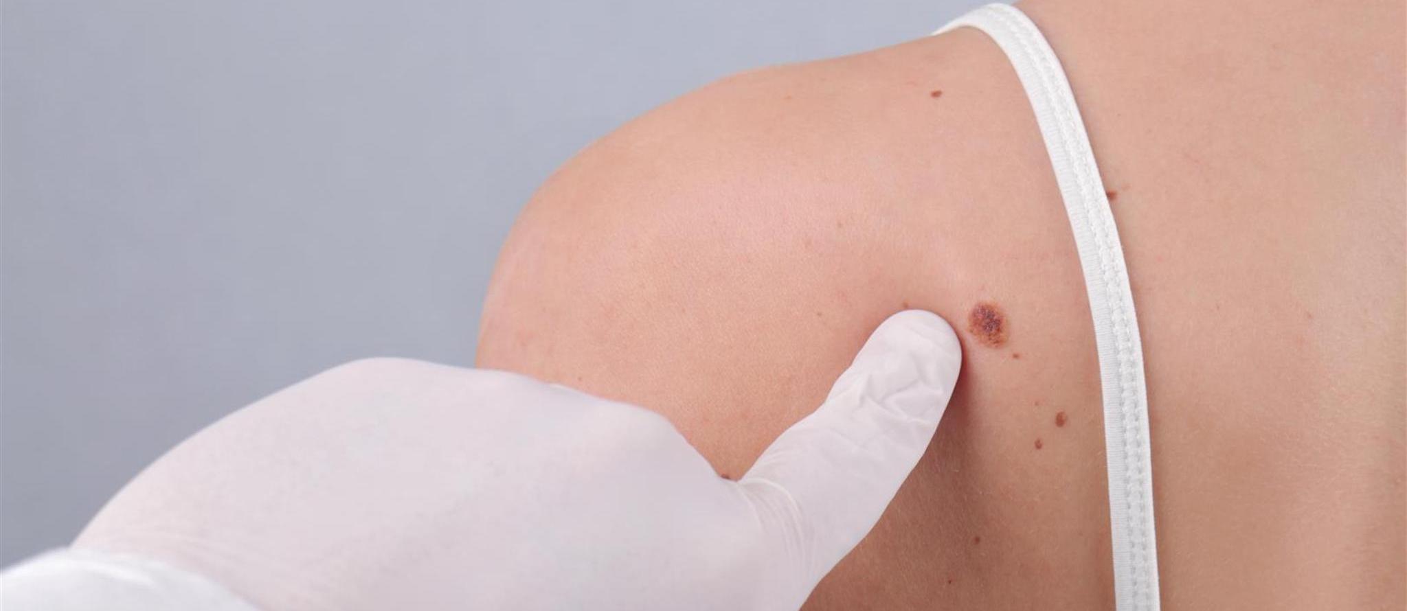 Dermatologie